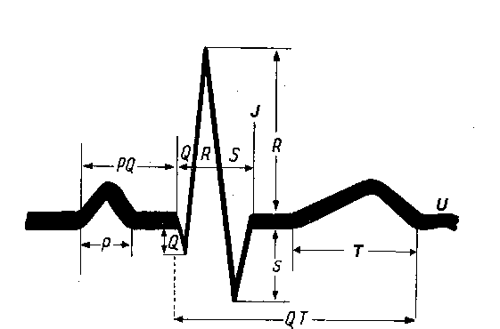 Wave Q: maximum 0.5 mV QRS complex – maximum 0.06 s
