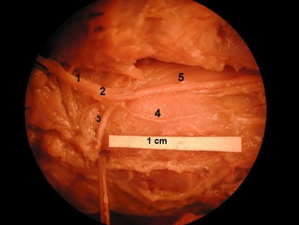 nodes in neck. lymph nodes in neck